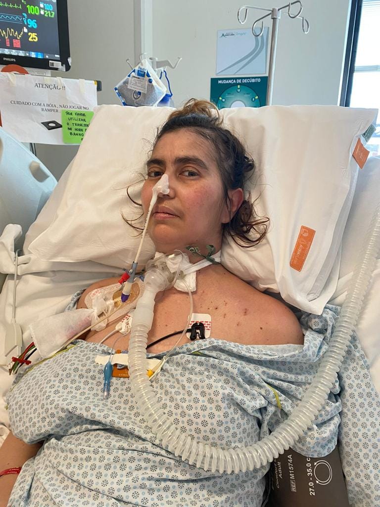 Botulism survivor recalls spending 314 days in intensive care
